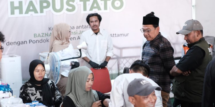 Program Jejak Baru BAZNAS Jabar Hadirkan Hapus Tato Gratis