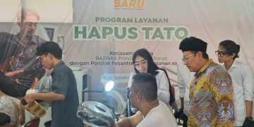 BAZNAS Jabar Buka Jalan Kerja Lewat Layanan Hapus Tato Gratis