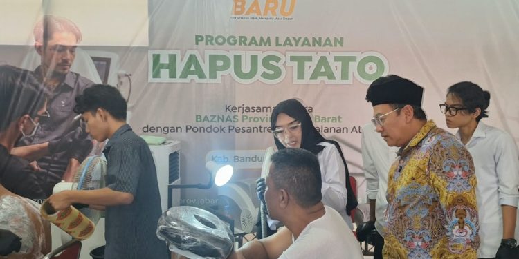 BAZNAS Jabar Buka Jalan Kerja Lewat Layanan Hapus Tato Gratis